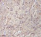 Anti-MLANA/Mart 1 Rabbit Monoclonal Antibody